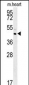TAMM41 Antibody (Center)